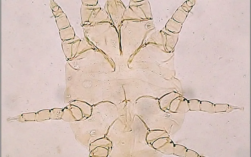 Microscopic morphology of adult Cytodites nudus respiratory air sac mite isolated from domestic poultry