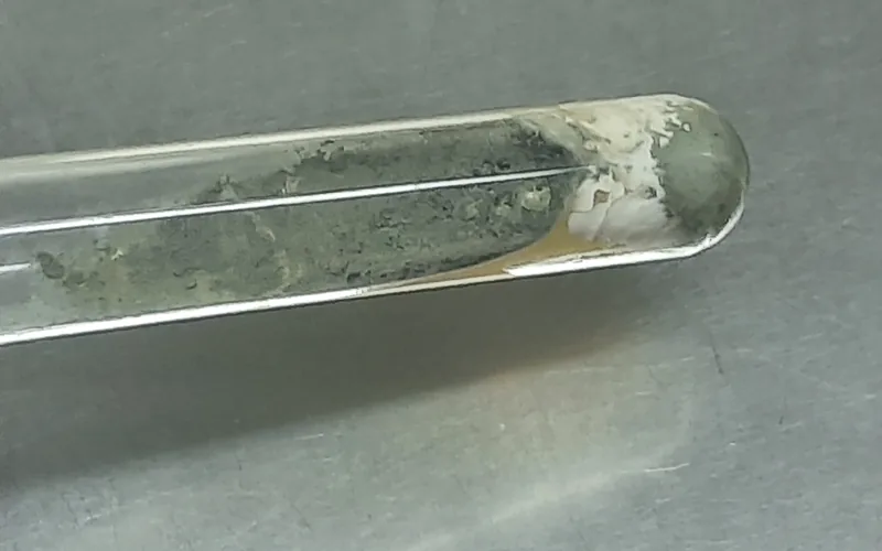 Aspergillosis: Yellow-Green Mycotic Granulomas
