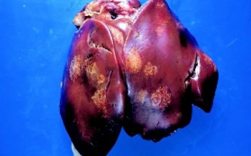 Gross necropsy of turkey liver showing characteristic circular depressed necrotic bull's-eye lesions caused by Histomonas meleagridis
