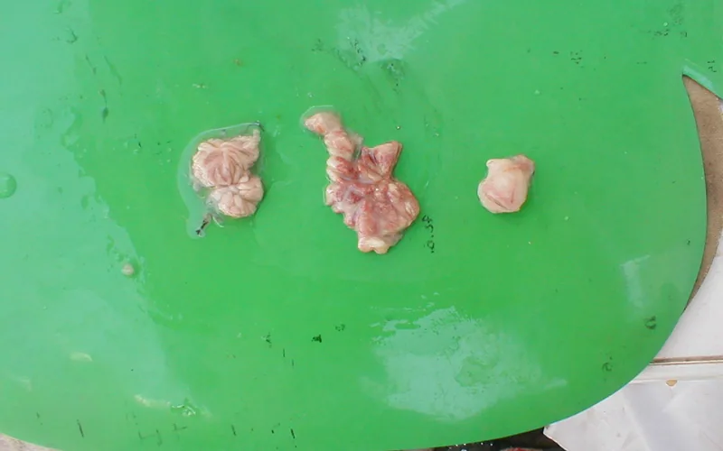 Necropsy of three Bursa of Fabricius showing chronic atrophic bursitis (left), acute edematous inflammation (middle), and normal bursa (right)