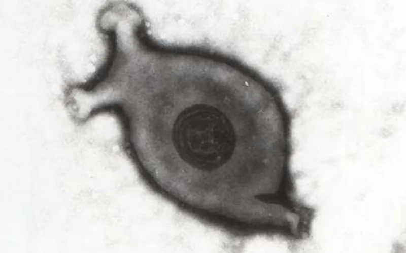 Scanning transmission electron micrograph of Mycoplasma gallisepticum highlighting the specialized terminal tip cytoadhesin organelle