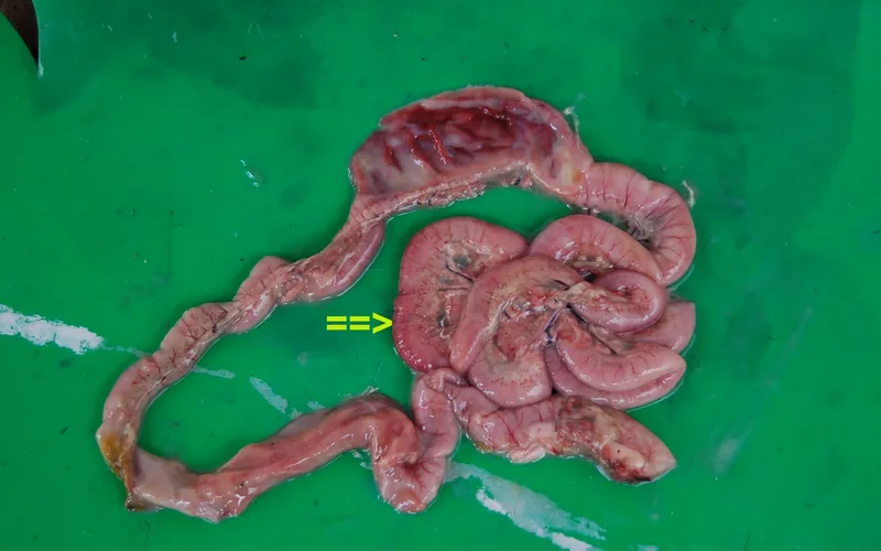 Broiler jejunum necropsy demonstrating friable, gas-distended intestine lined with diphtheritic pseudomembrane and mucosal necrosis