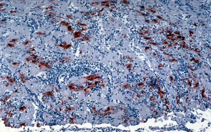 Velogenic Newcastle Disease: Acute Clinical Attack
