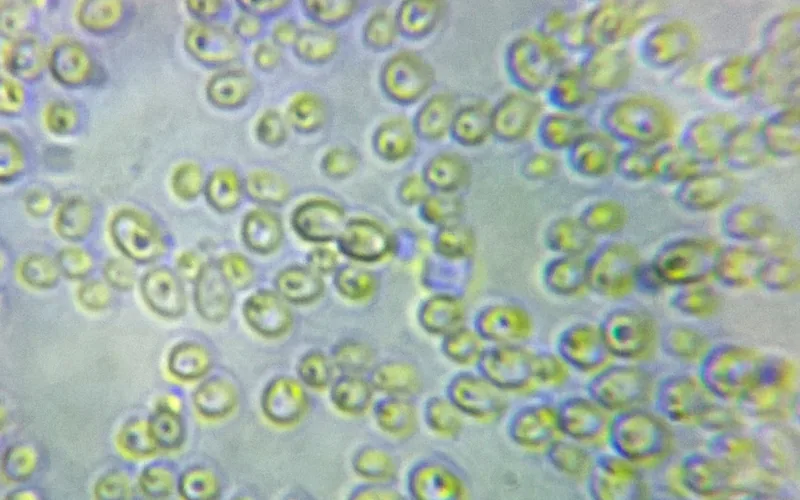 High power microscopic view of Candida albicans yeast cells and pseudohyphae