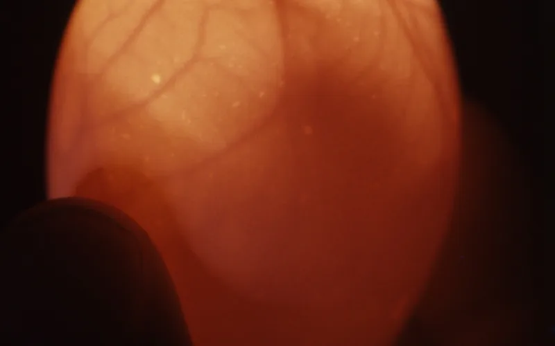 Candling an 11-day-old chicken egg showing vitelline and chorioallantoic blood vessels
